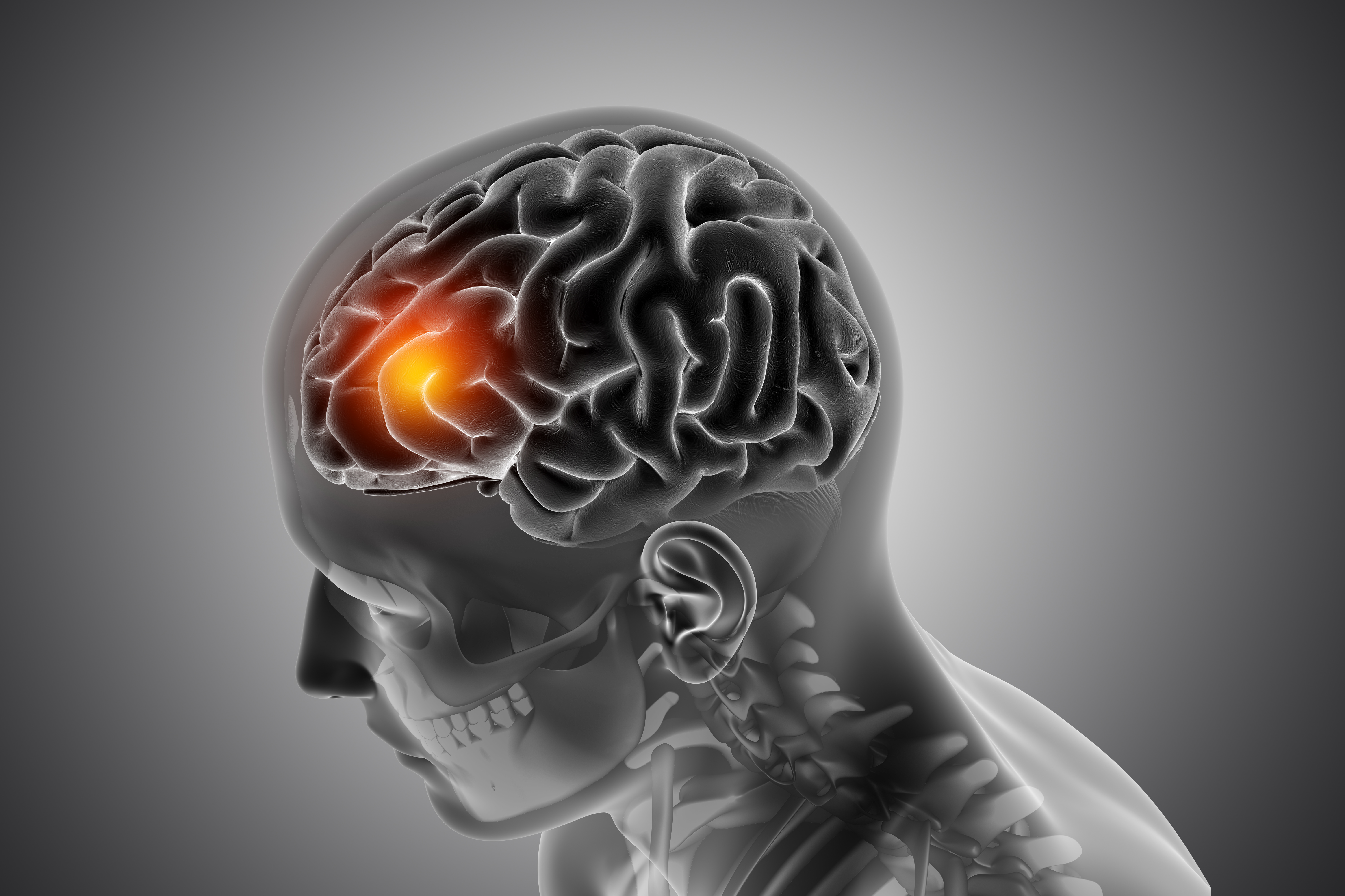 Neurological Symptoms